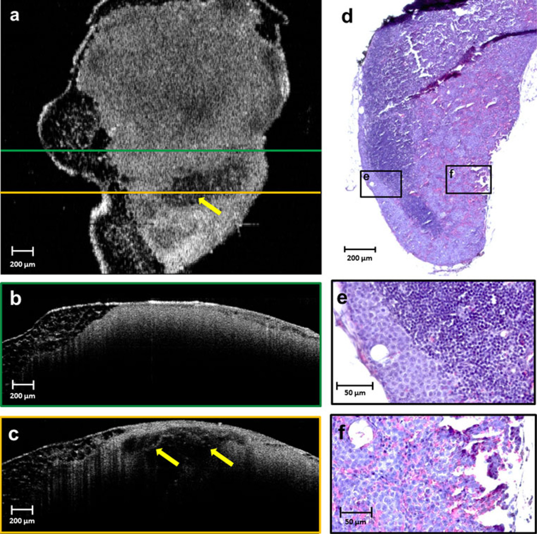 FIG. 5