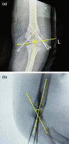 Fig. 3