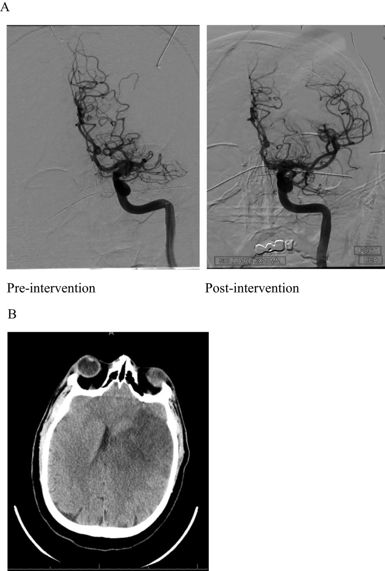 Fig. 4