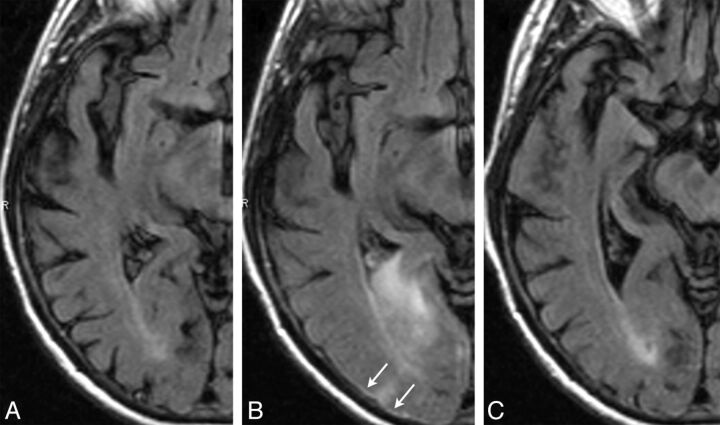 Fig 2.