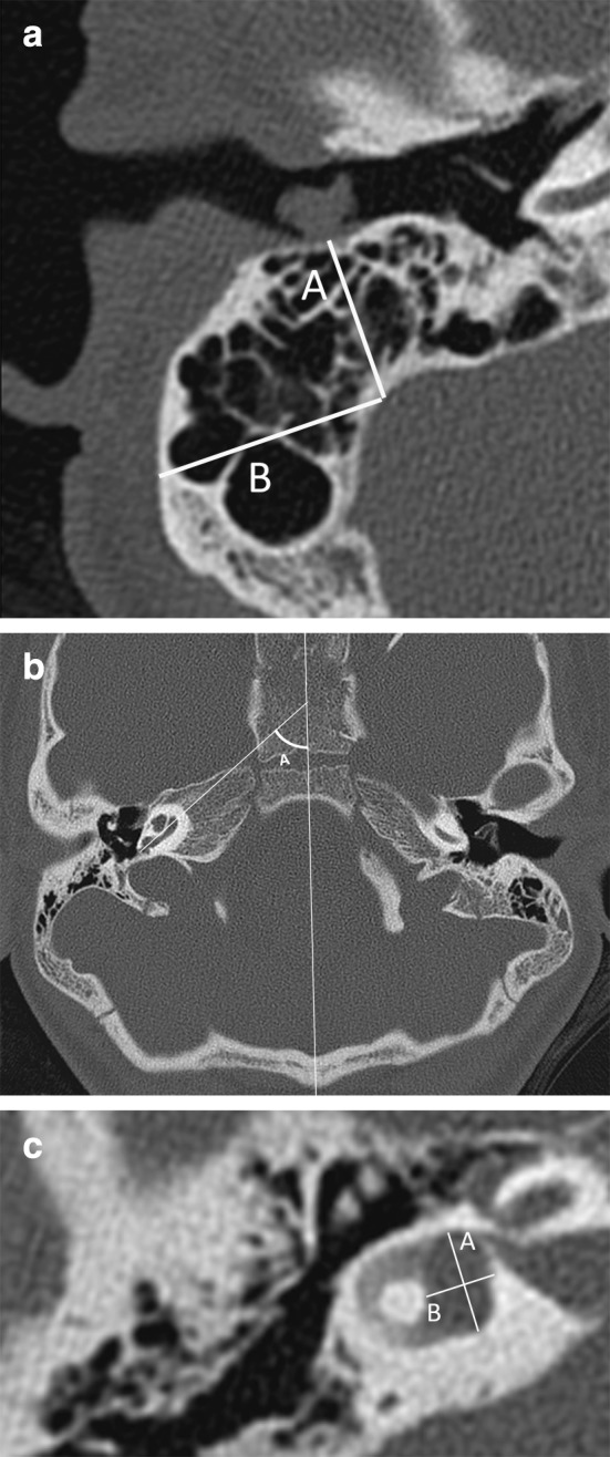 Fig. 1