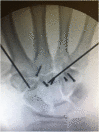 Fig. 3