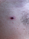 Fig 5