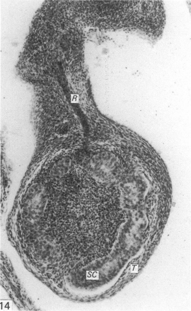 Fig. 14