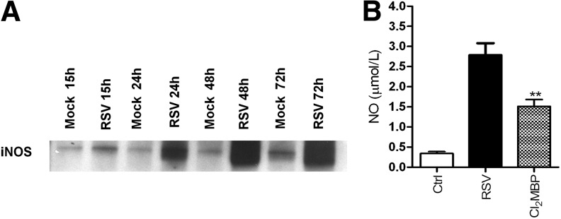 FIG. 12.