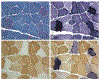 Fig. 10.1