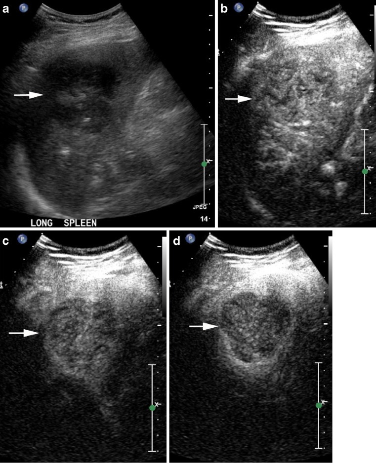 Fig. 4