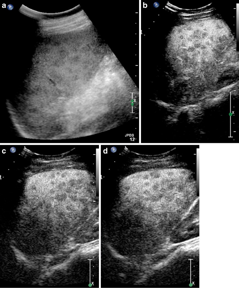 Fig. 11