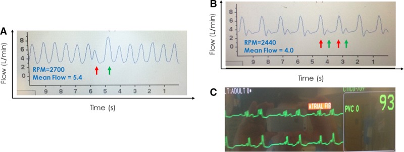 Figure 11.