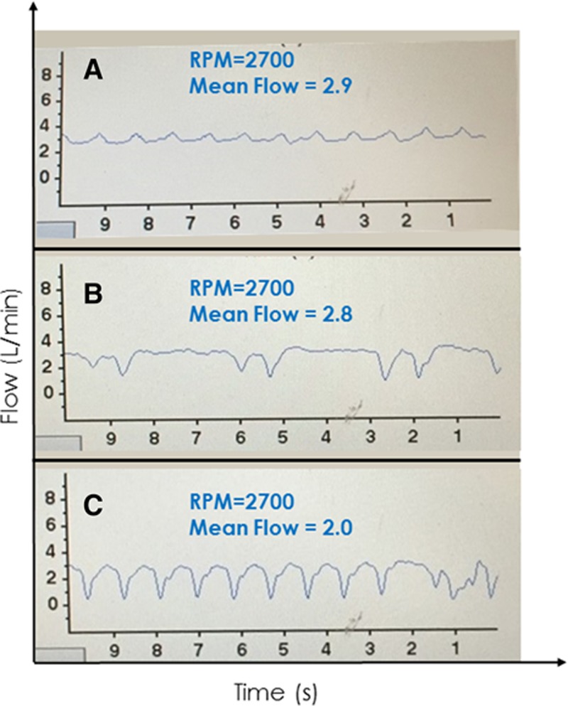 Figure 14.