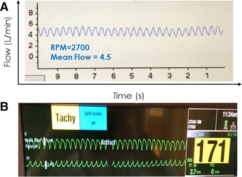 Figure 12.