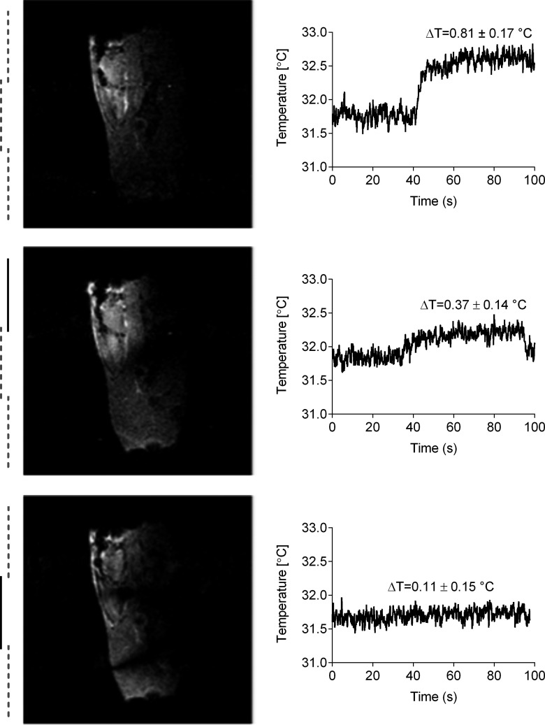 FIG. 11.