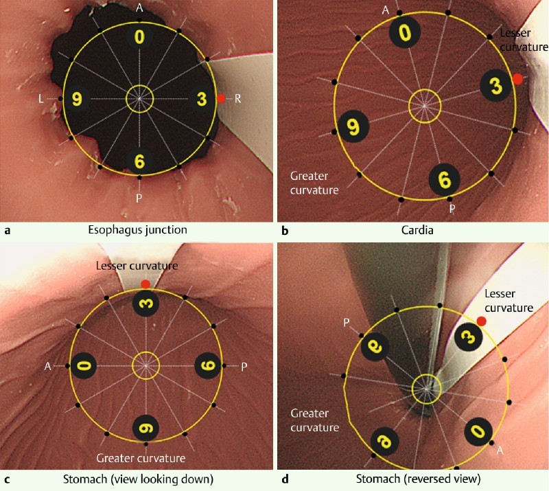 Fig. 2