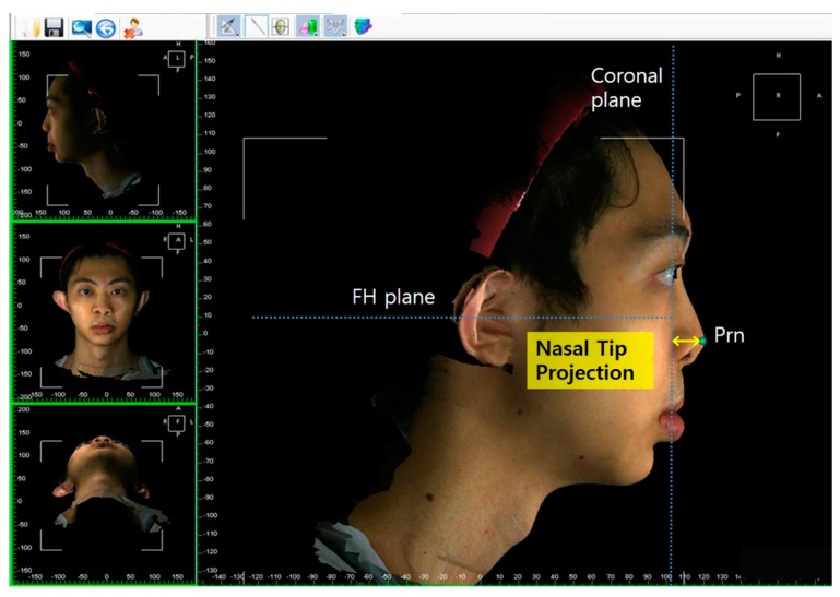 Figure 4