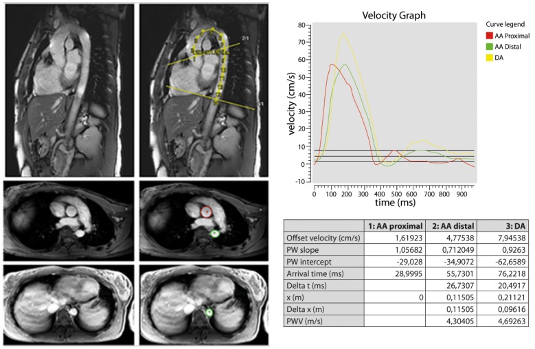 Fig 3