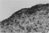 107
