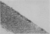 108