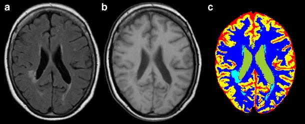 Fig. 1