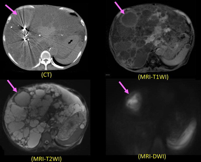 Fig. 3