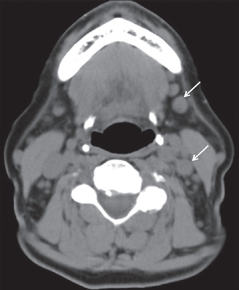 Figure 15