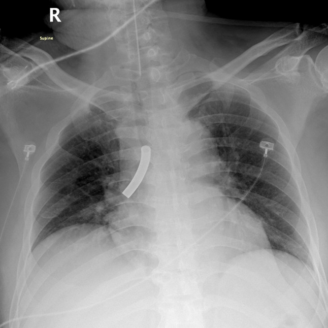 Fig. 1
