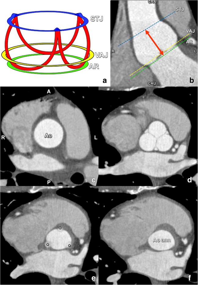 Fig. 11