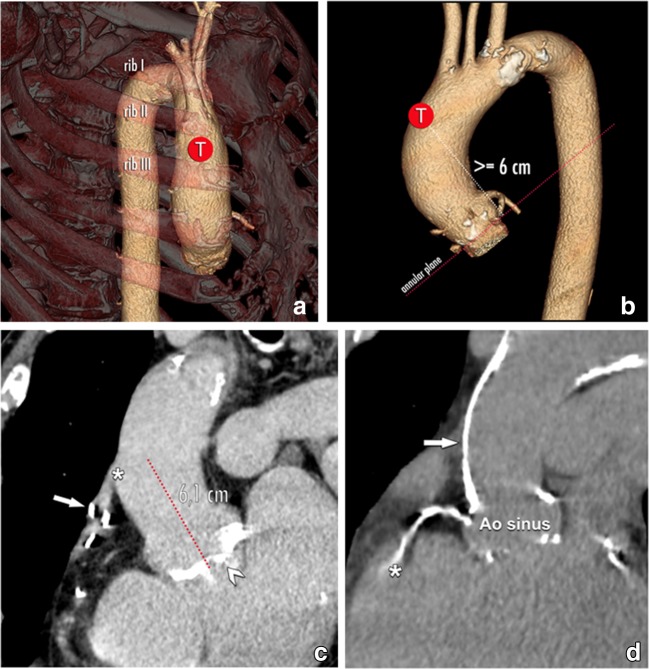 Fig. 15