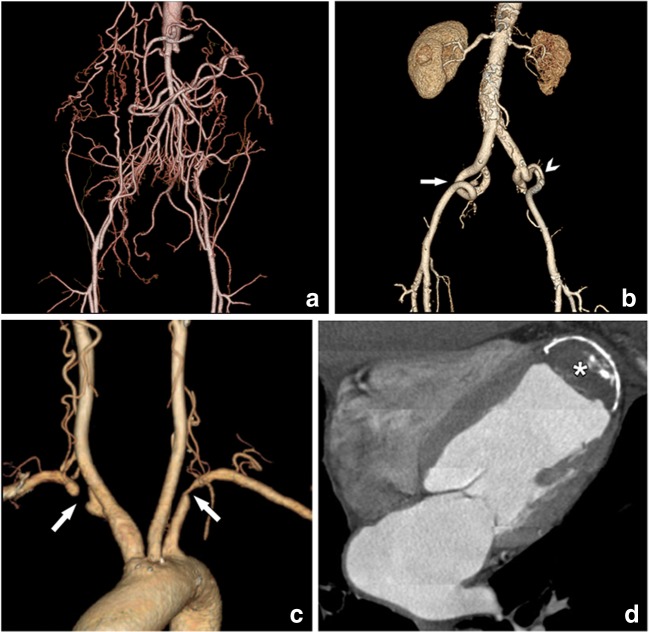 Fig. 16