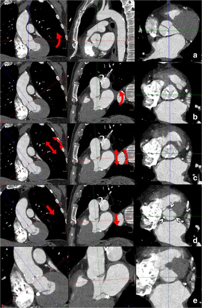 Fig. 12