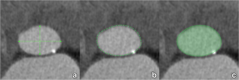 Fig. 13