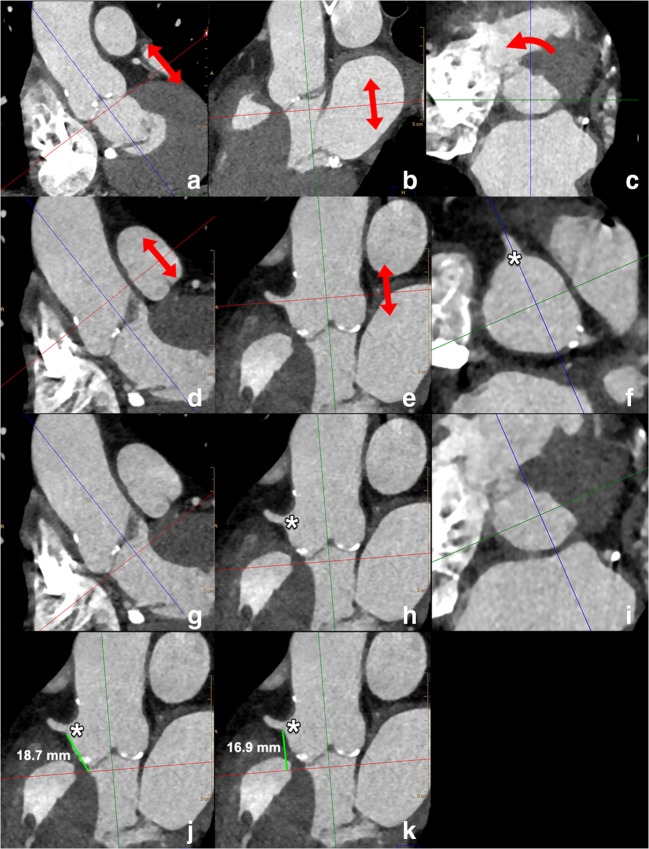 Fig. 14