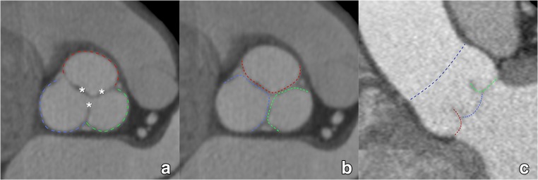 Fig. 3