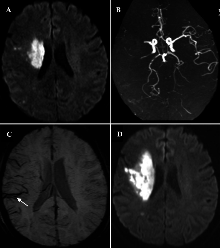 Fig. 1