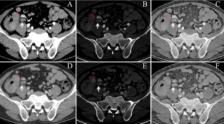 Figure 2