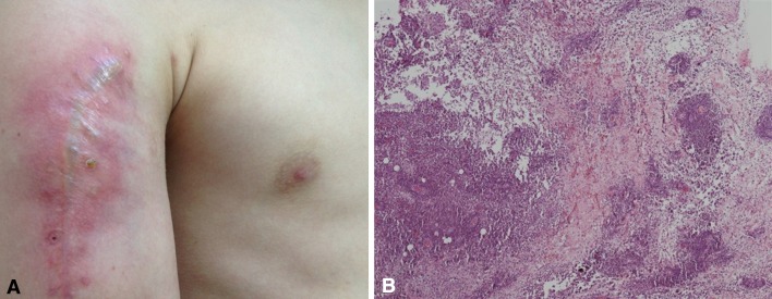 Fig. 1A–B