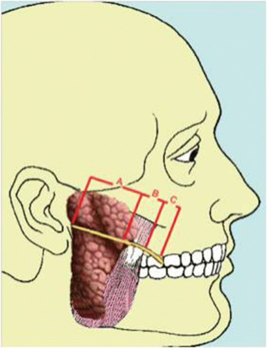 Fig. 1