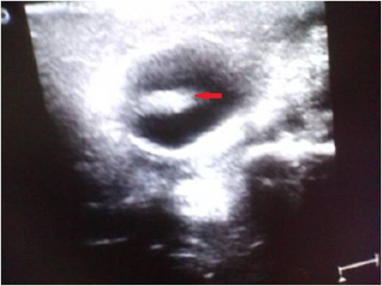 Fig. 3