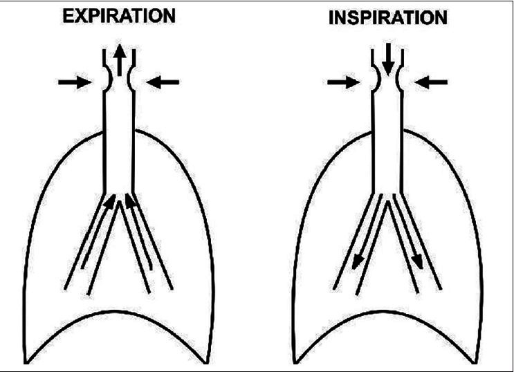 Figure 3c