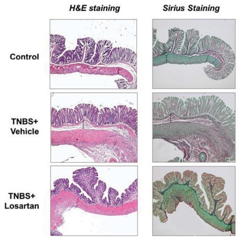 Figure 2)