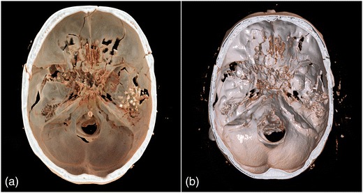 Fig. 7