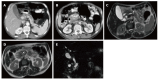 Figure 17