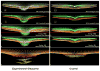 Figure 37
