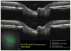 Figure 28