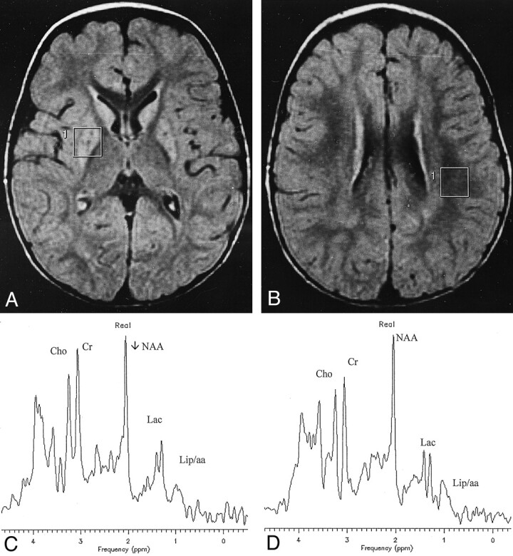 Fig 1.