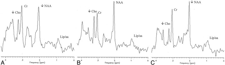 Fig 3.