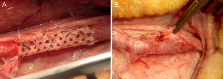 Figure 2: