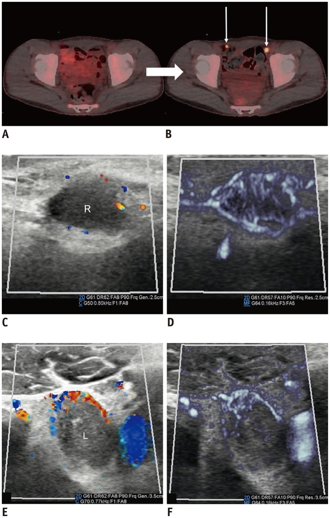 Fig. 14