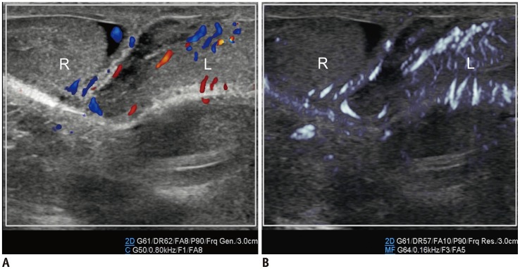 Fig. 12