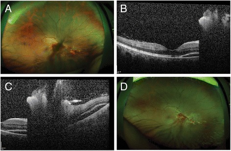 Fig. 1