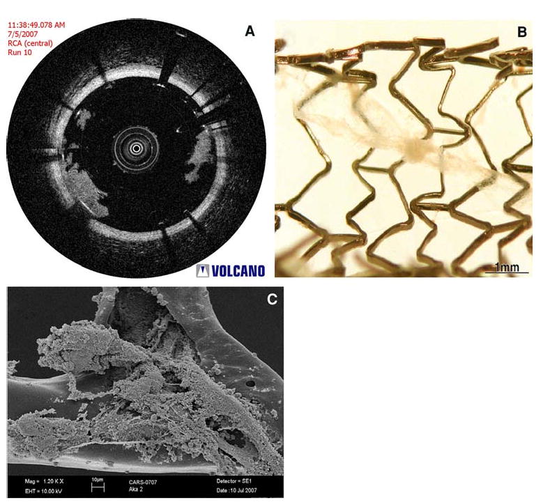 Figure 11